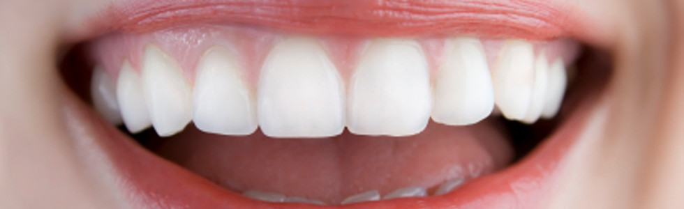 Ästhetische Zahnheilkunde Frontzahnverschönerungen